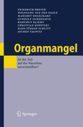Cover: Organmangel - Springer