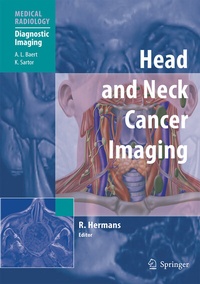 Abbildung von: Head and Neck Cancer Imaging - Springer