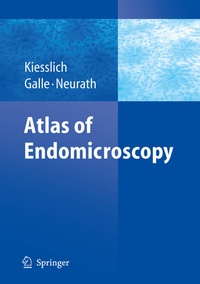 Abbildung von: Atlas of Endomicroscopy - Springer