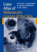Cover: Color Atlas of Melanocytic Lesions of the Skin - Springer