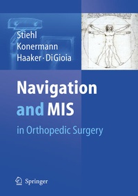Enlarge image Cover: Navigation and MIS in Orthopedic Surgery - Springer