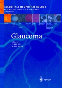 Abbildung von: Glaucoma - Springer