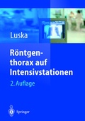 Abbildung von: Röntgenthorax auf Intensivstationen - Springer