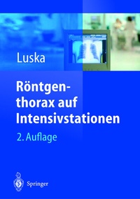 Abbildung von: Röntgenthorax auf Intensivstationen - Springer