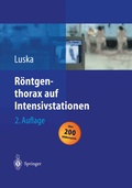 Abbildung von: Röntgenthorax auf Intensivstationen - Springer
