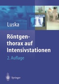Bild: Röntgenthorax auf Intensivstationen - Springer
