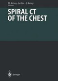 Cover: Spiral CT of the Chest - Springer