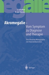 Abbildung von: Akromegalie - Vom Symptom zu Diagnose und Therapie - Springer