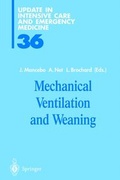 Abbildung von: Mechanical Ventilation and Weaning - Springer