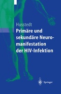 Abbildung von: Primäre und sekundäre Neuromanifestationen der HIV-Infektion - Springer