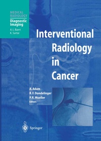 Abbildung von: Interventional Radiology in Cancer - Springer