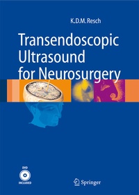 Abbildung von: Transendoscopic Ultrasound for Neurosurgery - Springer