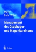Cover: Management des Magen- und &Ouml;sophaguskarzinoms - Springer