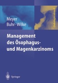 Cover: Management des Magen- und &Ouml;sophaguskarzinoms - Springer