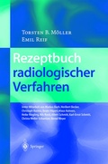 Cover: Rezeptbuch radiologischer Verfahren - Springer