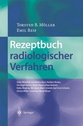 Cover: Rezeptbuch radiologischer Verfahren - Springer