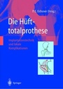Cover: Die H&uuml;fttotalprothese - Springer