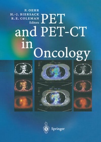 Abbildung von: PET and PET-CT in Oncology - Springer
