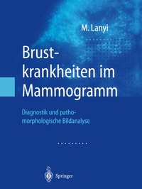 Abbildung von: Brustkrankheiten im Mammogramm - Springer