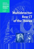 Bild: Multidetector-Row CT of the Thorax - Springer