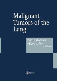 Abbildung von: Malignant Tumors of the Lung - Springer