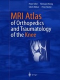 Cover: MRI Atlas of Orthopedics and Traumatology of the Knee - Springer