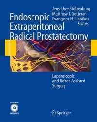 Abbildung von: Endoscopic Extraperitoneal Radical Prostatectomy - Springer
