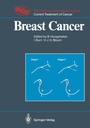 Cover: Breast Cancer - Springer