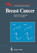 Cover: Breast Cancer - Springer