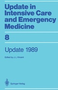 Cover: Update 1989 - Springer