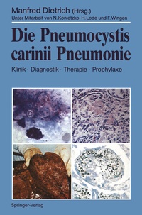 Abbildung von: Die Pneumocystis carinii Pneumonie - Springer