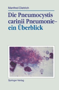 Abbildung von: Die Pneumocystis carinii Pneumonie- ein Überblick - Springer