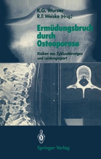 Abbildung von: Ermüdungsbruch durch Osteoporose - Springer