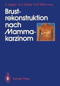 Cover: Brustrekonstruktion nach Mammakarzinom - Springer