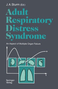 Abbildung von: Adult Respiratory Distress Syndrome - Springer