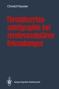 Cover: Thrombozytenszintigraphie bei zerebrovaskul&auml;ren Erkrankungen - Springer