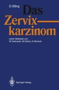 Cover: Das Zervixkarzinom - Springer