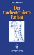 Abbildung von: Der tracheotomierte Patient - Springer