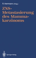 Cover: ZNS-Metastasierung des Mammakarzinoms - Springer
