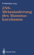 Abbildung von: ZNS-Metastasierung des Mammakarzinoms - Springer
