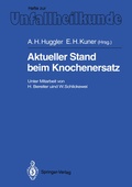 Cover: Aktueller Stand beim Knochenersatz - Springer