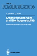 Cover: Kronenfortsatzbr&uuml;che und Ellenbogenstabilit&auml;t - Springer