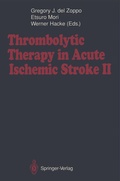 Bild: Thrombolytic Therapy in Acute Ischemic Stroke II - Springer