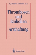 Bild: Thrombosen und Embolien: Arzthaftung - Springer
