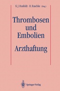 Bild: Thrombosen und Embolien: Arzthaftung - Springer