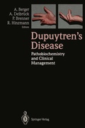Cover: Dupuytren's Disease - Springer