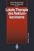 Cover: Lokale Therapie des Rektumkarzinoms - Springer