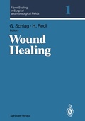 Cover: Fibrin Sealing in Surgical and Nonsurgical Fields - Springer