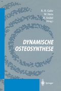 Cover: Dynamische Osteosynthese - Springer