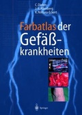 Cover: Farbatlas der Gef&auml;sskrankheiten - Springer